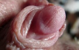 clitoris decalote